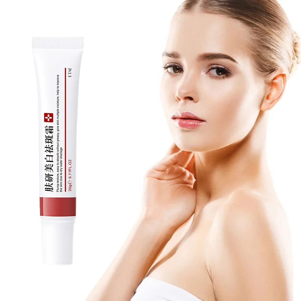 Effective Freckle Cream Fast Brighten Face Remove Melasma Dark Spot Fade Melanin Whiten Anti-pigmentation Improve Dullness